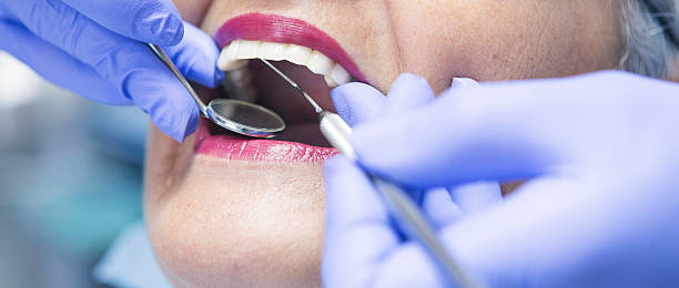 Best Emergency Cosmetic Dentistry (e.g., broken veneers) in Bliss Corner, MA